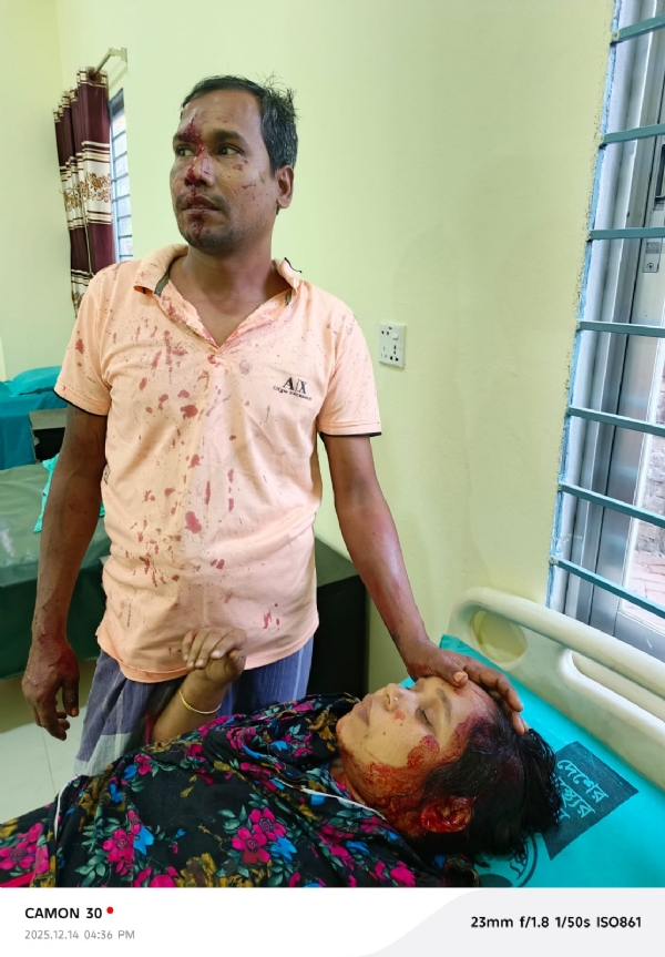 ਬੰਗਲਾਦੇਸ਼ ’ਚ ਹਮਲੇ ਵਿੱਚ ਜ਼ਖਮੀ ਪੀੜਤ ਪਰਿਵਾਰ ਬੰਗਲਾਦੇਸ਼ ’ਚ ਹਮਲੇ ਵਿੱਚ ਜ਼ਖਮੀ ਪੀੜਤ ਪਰਿਵਾਰ