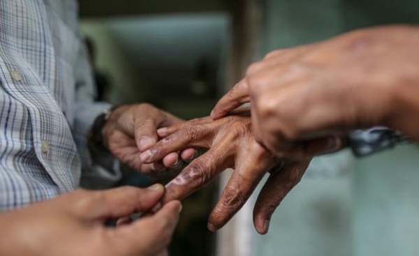 ਪ੍ਰਤੀਕਾਤਮਕ।