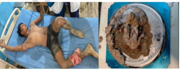 ਪੁਲਿਸ ਮੁਕਾਬਲੇ ਵਿੱਚ ਜ਼ਖਮੀ ਭਾਰਤੀ ਨਸ਼ਾ ਤਸਕਰ ਅਤੇ ਬਰਾਮਦ ਨਸ਼ੀਲਾ ਪਦਾਰਥ ਪੁਲਿਸ ਮੁਕਾਬਲੇ ਵਿੱਚ ਜ਼ਖਮੀ ਭਾਰਤੀ ਨਸ਼ਾ ਤਸਕਰ ਅਤੇ ਬਰਾਮਦ ਨਸ਼ੀਲਾ ਪਦਾਰਥ